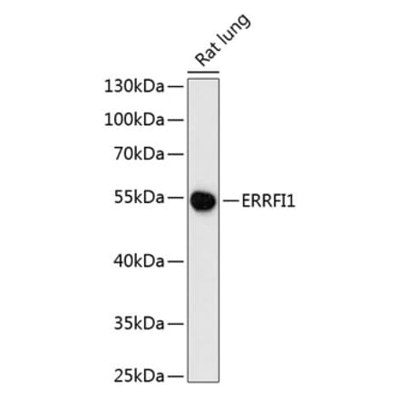 Western Blot - Anti-MIG-6 Antibody (A90264) - Antibodies.com