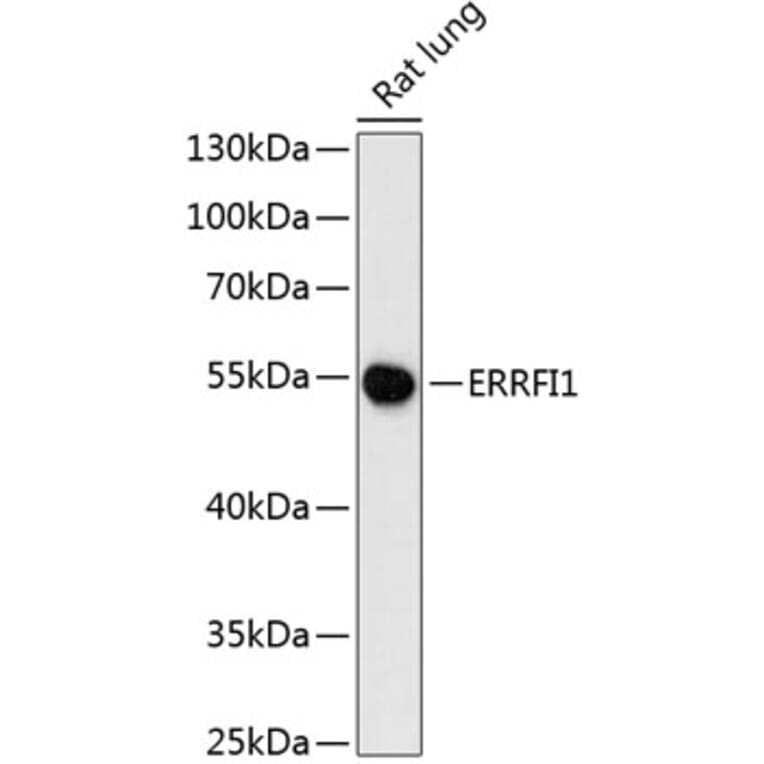 Western Blot - Anti-MIG-6 Antibody (A90264) - Antibodies.com