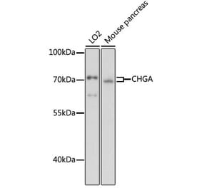 Western Blot - Anti-Chromogranin A Antibody (A90265) - Antibodies.com