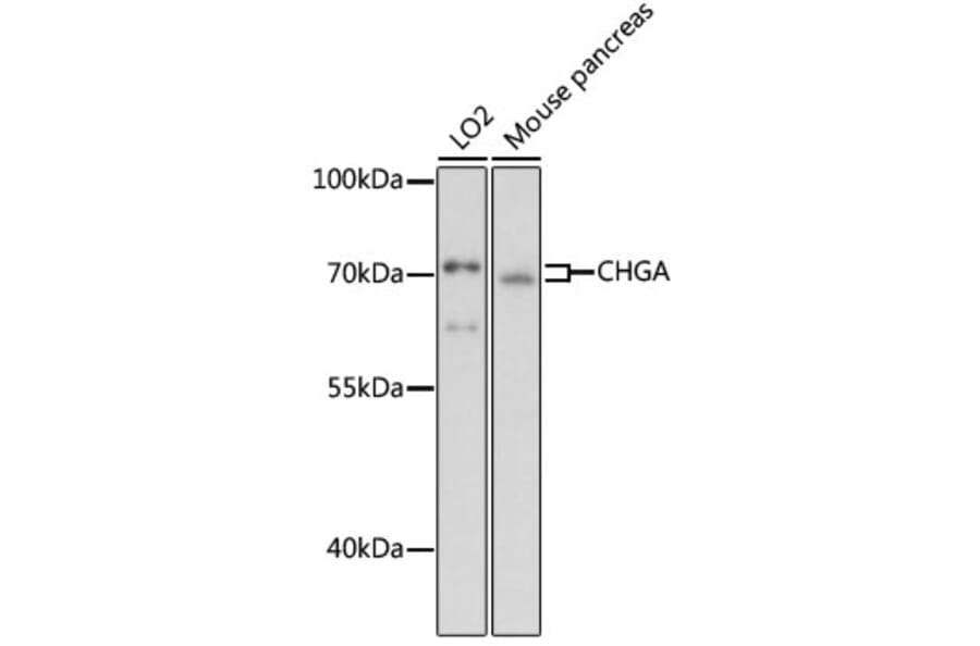 Western Blot - Anti-Chromogranin A Antibody (A90265) - Antibodies.com