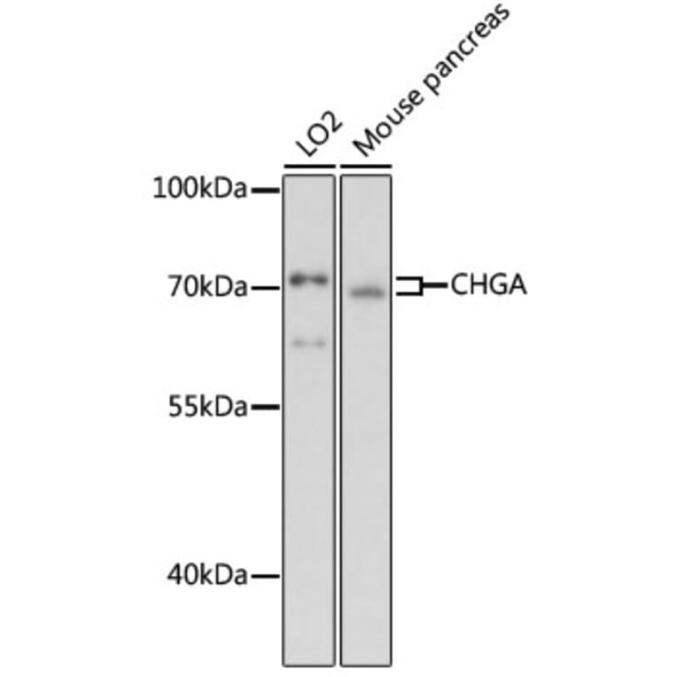 Western Blot - Anti-Chromogranin A Antibody (A90265) - Antibodies.com