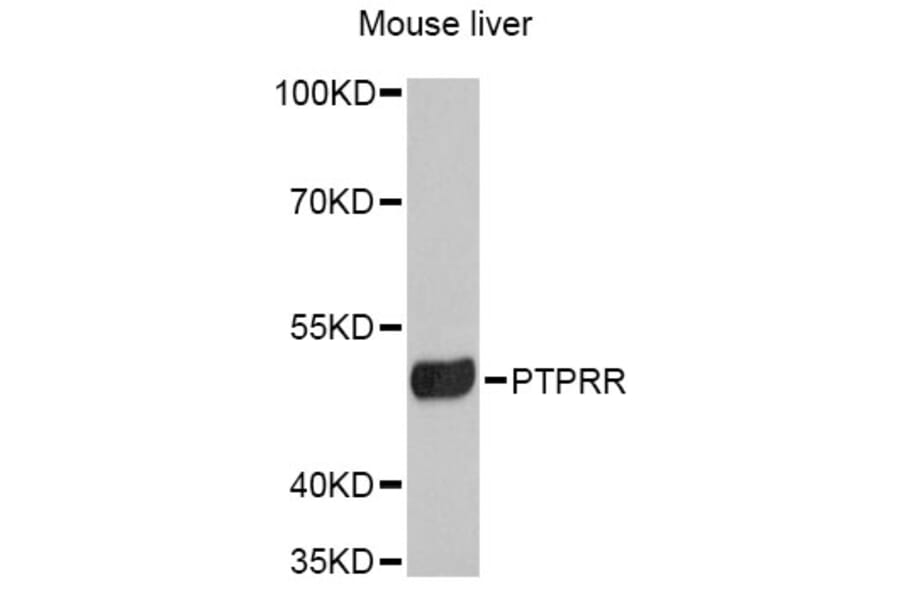 Western Blot - Anti-PTPRR Antibody (A12113) - Antibodies.com