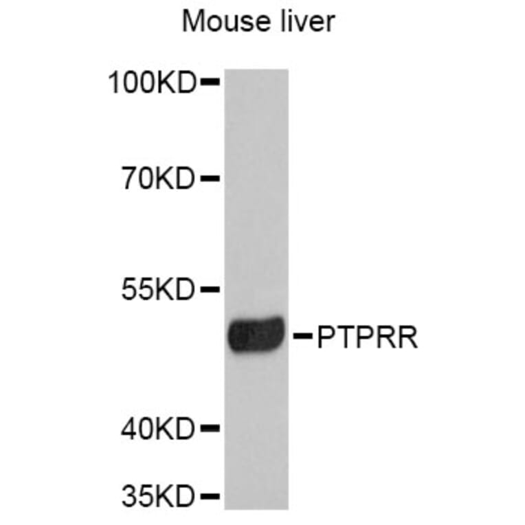 Western Blot - Anti-PTPRR Antibody (A12113) - Antibodies.com