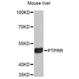 Western Blot - Anti-PTPRR Antibody (A12113) - Antibodies.com