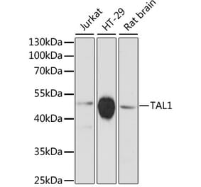 Western Blot - Anti-Tal1 Antibody (A90267) - Antibodies.com