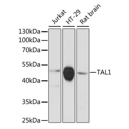 Western Blot - Anti-Tal1 Antibody (A90267) - Antibodies.com