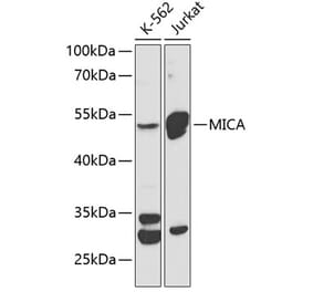 Western Blot - Anti-MICA Antibody (A90268) - Antibodies.com