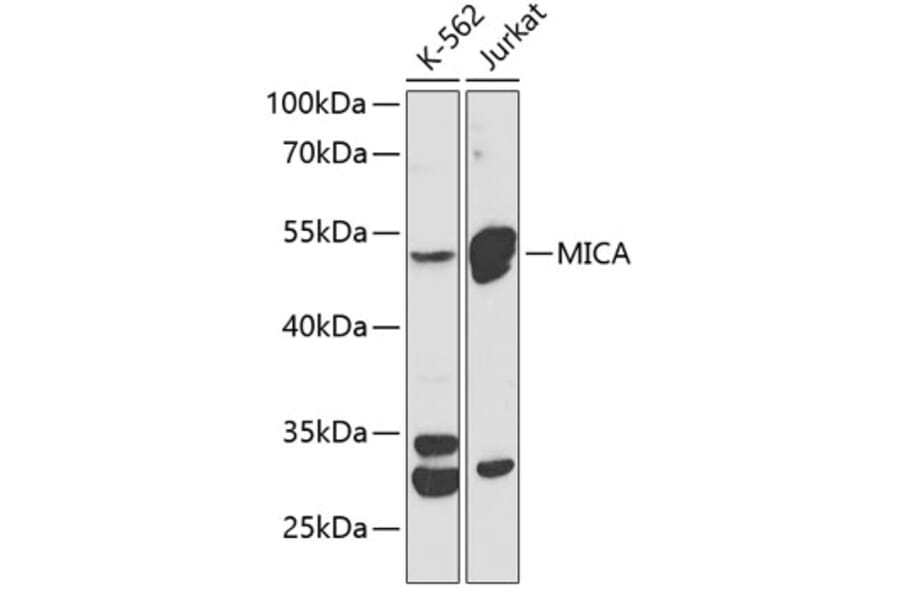 Western Blot - Anti-MICA Antibody (A90268) - Antibodies.com