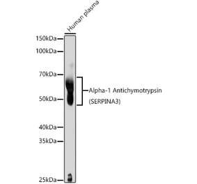 Western Blot - Anti-AACT Antibody (A90269) - Antibodies.com