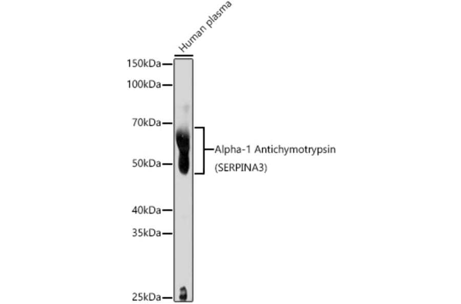 Western Blot - Anti-AACT Antibody (A90269) - Antibodies.com