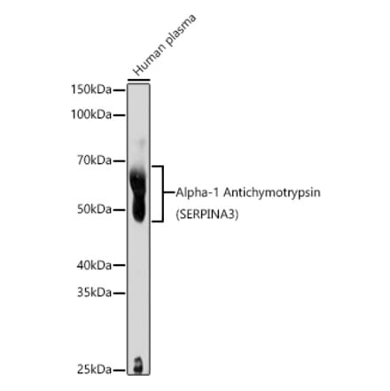 Western Blot - Anti-AACT Antibody (A90269) - Antibodies.com