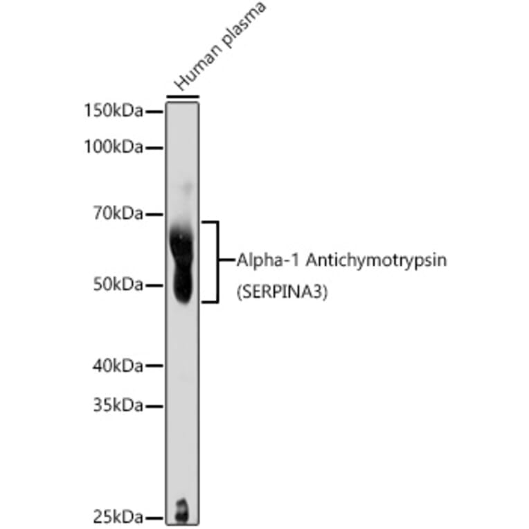 Western Blot - Anti-AACT Antibody (A90269) - Antibodies.com