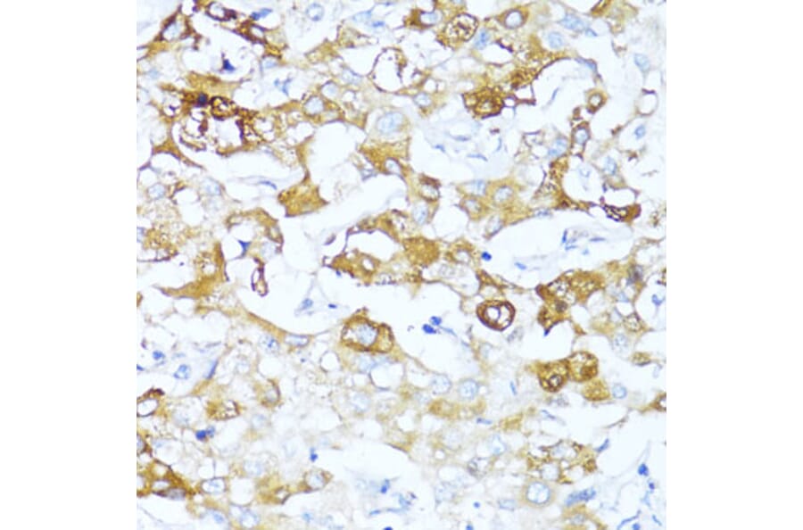 Immunohistochemistry - Anti-AACT Antibody (A90269) - Antibodies.com