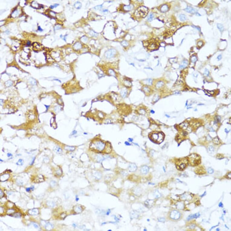 Immunohistochemistry - Anti-AACT Antibody (A90269) - Antibodies.com