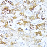 Immunohistochemistry - Anti-AACT Antibody (A90269) - Antibodies.com