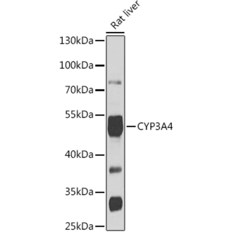 Western Blot - Anti-Cytochrome P450 3A4/CYP3A4 Antibody (A90270) - Antibodies.com