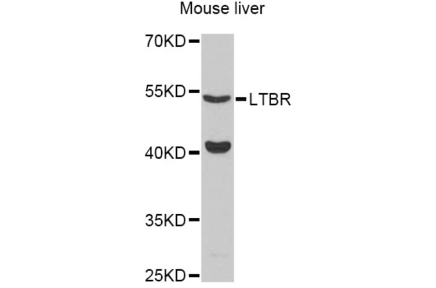 Western Blot - Anti-LTBR Antibody (A12006) - Antibodies.com