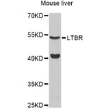 Western Blot - Anti-LTBR Antibody (A12006) - Antibodies.com
