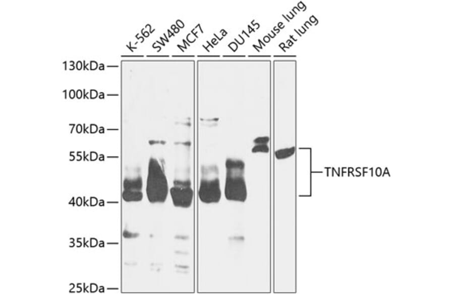 Western Blot - Anti-DR4 Antibody (A90272) - Antibodies.com