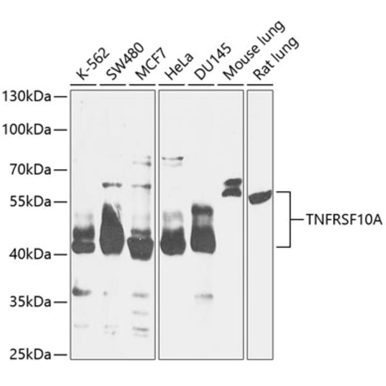 Western Blot - Anti-DR4 Antibody (A90272) - Antibodies.com