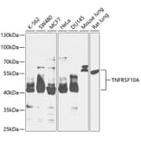 Western Blot - Anti-DR4 Antibody (A90272) - Antibodies.com