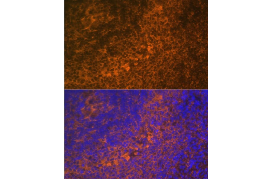 Immunofluorescence - Anti-DR4 Antibody (A90272) - Antibodies.com