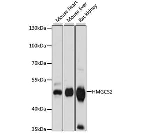 Western Blot - Anti-HMGCS2 Antibody (A90273) - Antibodies.com