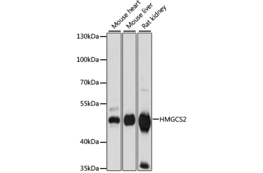 Western Blot - Anti-HMGCS2 Antibody (A90273) - Antibodies.com