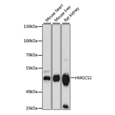 Western Blot - Anti-HMGCS2 Antibody (A90273) - Antibodies.com