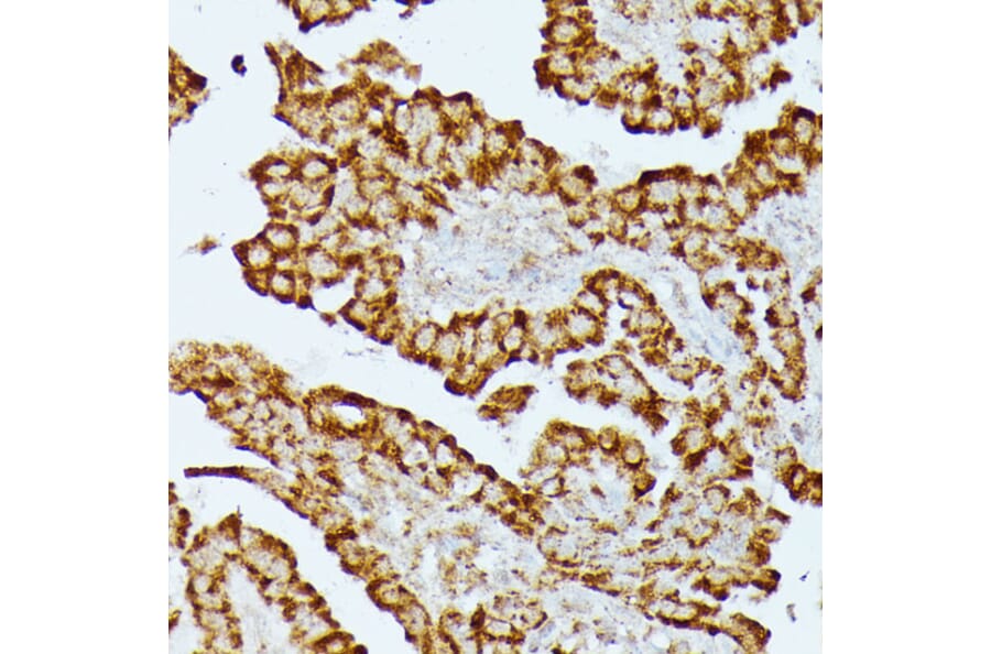 Immunohistochemistry - Anti-HMGCS2 Antibody (A90273) - Antibodies.com