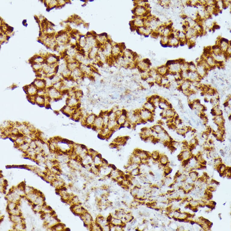 Immunohistochemistry - Anti-HMGCS2 Antibody (A90273) - Antibodies.com