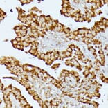 Immunohistochemistry - Anti-HMGCS2 Antibody (A90273) - Antibodies.com