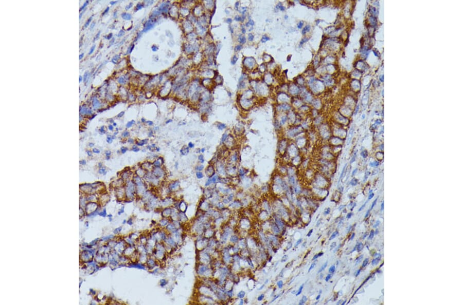 Immunohistochemistry - Anti-HMGCS2 Antibody (A90273) - Antibodies.com