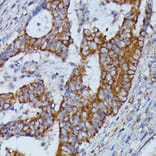 Immunohistochemistry - Anti-HMGCS2 Antibody (A90273) - Antibodies.com