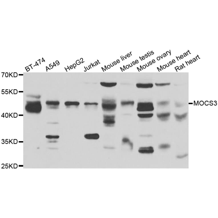 Western Blot - Anti-MOCS3 Antibody (A13417) - Antibodies.com