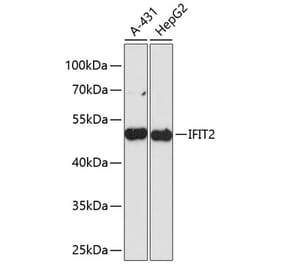 Western Blot - Anti-IFIT2 Antibody (A90275) - Antibodies.com