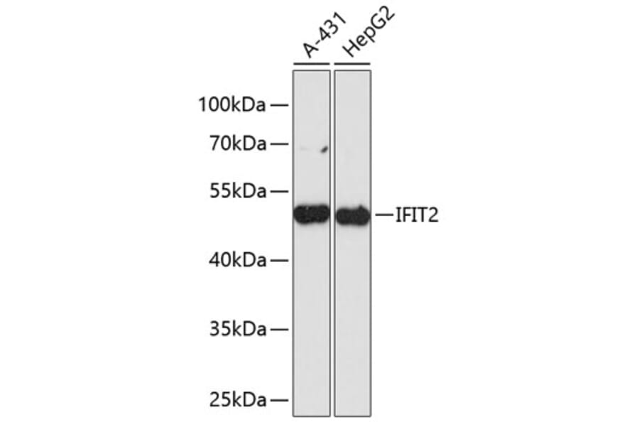 Western Blot - Anti-IFIT2 Antibody (A90275) - Antibodies.com