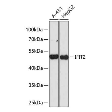 Western Blot - Anti-IFIT2 Antibody (A90275) - Antibodies.com