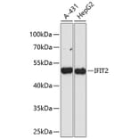 Western Blot - Anti-IFIT2 Antibody (A90275) - Antibodies.com