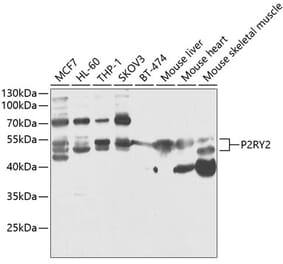 Western Blot - Anti-P2Y2 Antibody (A90276) - Antibodies.com