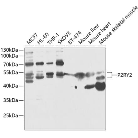 Western Blot - Anti-P2Y2 Antibody (A90276) - Antibodies.com