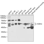 Western Blot - Anti-P2Y2 Antibody (A90276) - Antibodies.com