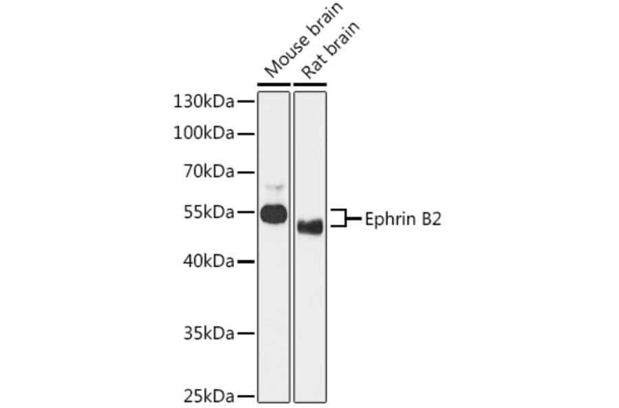 Western Blot - Anti-Ephrin B2 Antibody (A90277) - Antibodies.com