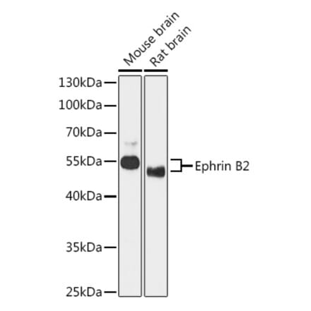 Western Blot - Anti-Ephrin B2 Antibody (A90277) - Antibodies.com