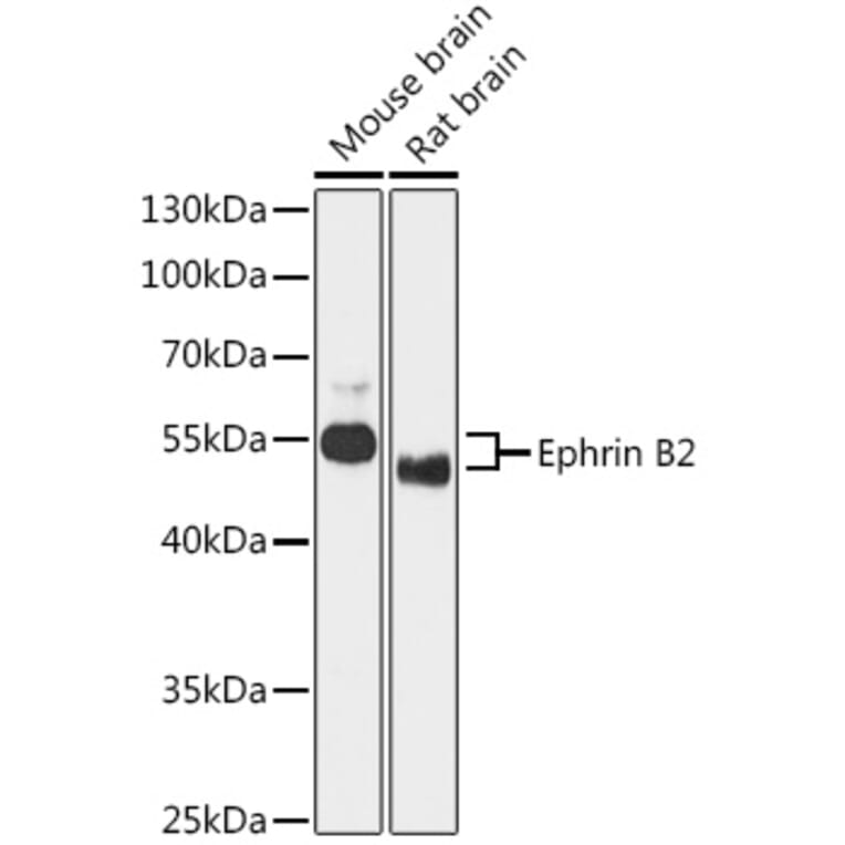 Western Blot - Anti-Ephrin B2 Antibody (A90277) - Antibodies.com