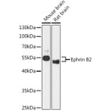 Western Blot - Anti-Ephrin B2 Antibody (A90277) - Antibodies.com