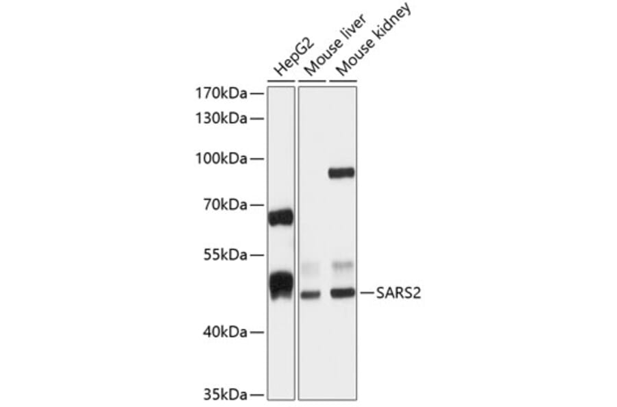 Western Blot - Anti-SARS2 Antibody (A90278) - Antibodies.com