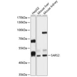Western Blot - Anti-SARS2 Antibody (A90278) - Antibodies.com