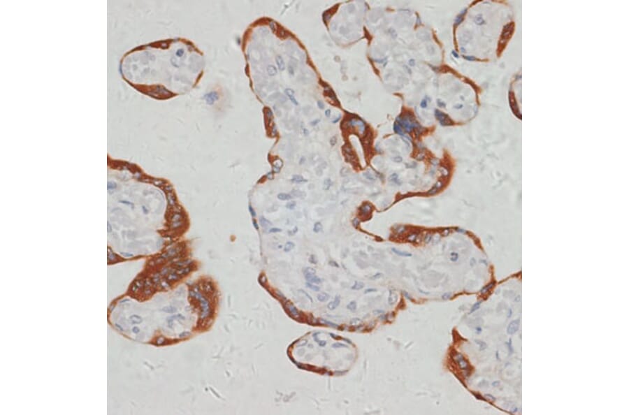 Immunohistochemistry - Anti-SARS2 Antibody (A90278) - Antibodies.com