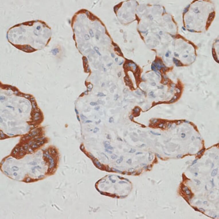 Immunohistochemistry - Anti-SARS2 Antibody (A90278) - Antibodies.com